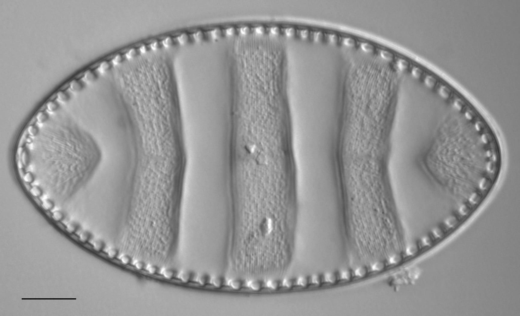 Surirella undulata LM3