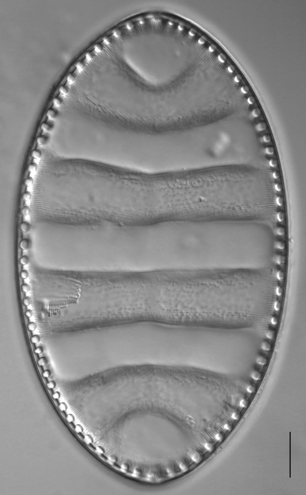 Surirella undulata LM1