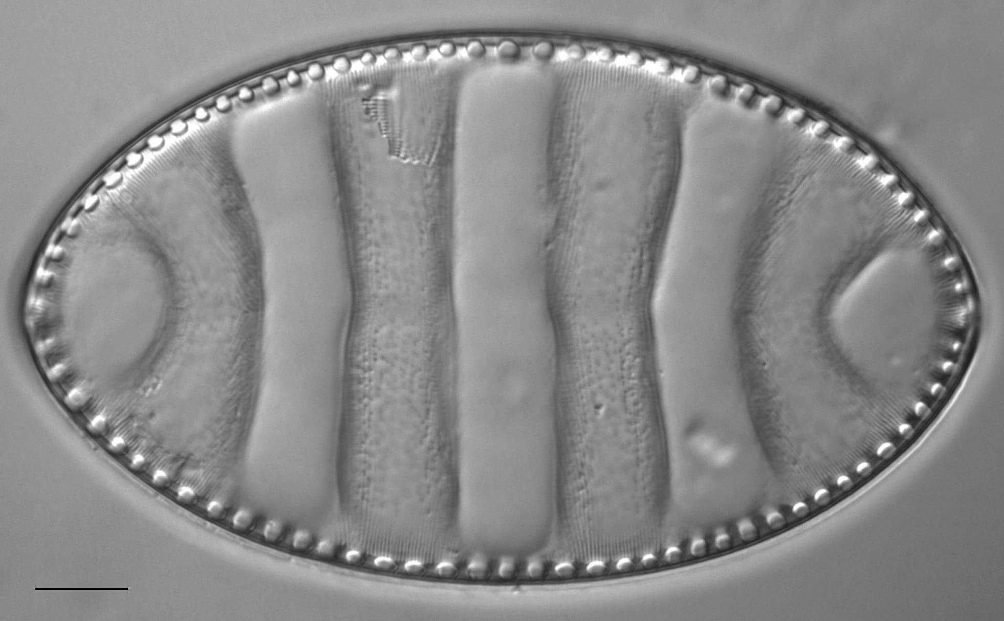 Surirella undulata LM1