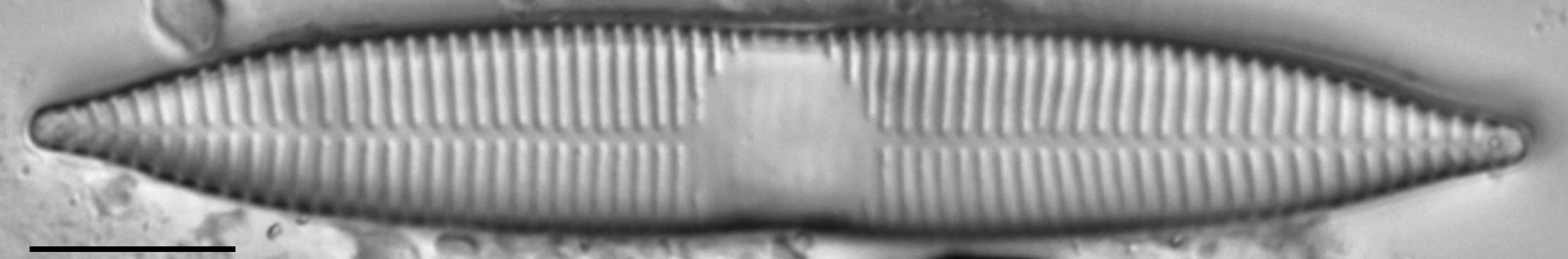 Synedra goulardi LM1