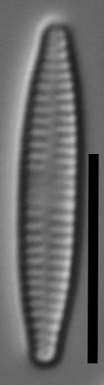 Fragilaria rumpens LM2