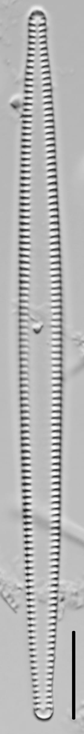 Tabularia fasciculata LM3