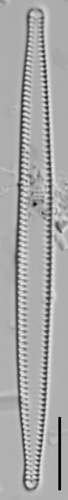 Tabularia fasciculata LM2