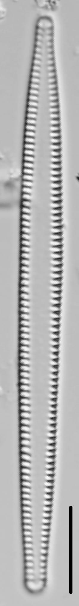 Tabularia fasciculata LM1