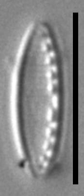 Taxa ICF22 SDAC001 100x 03042023001 Overlay007 cl