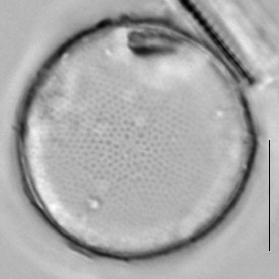 Thalassiosira baltica LM5
