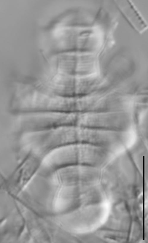 Tetracyclus emarginatus LM3