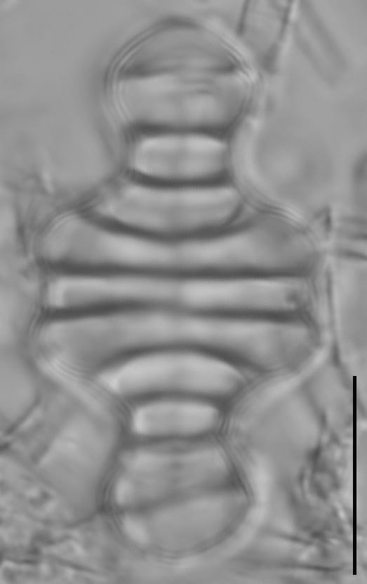 Tetracyclus emarginatus LM6