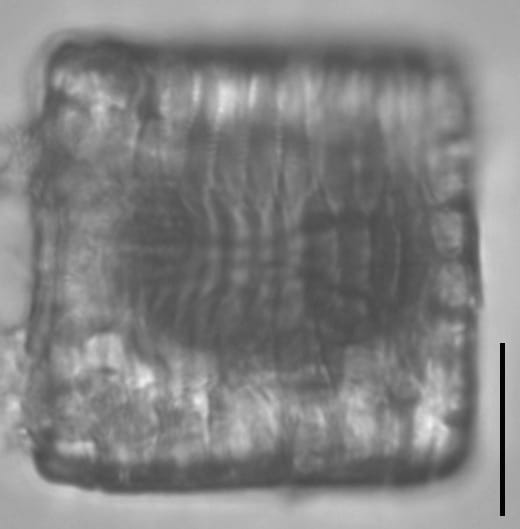 Tetracyclus emarginatus LM2