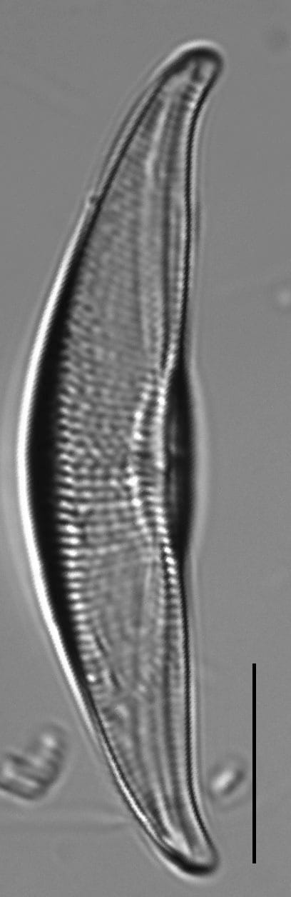 Tetramphora sulcata LM5