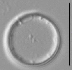 Thalassiosira minima LM2