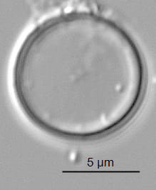 Thalassiosira minima ANSP GC59341 03