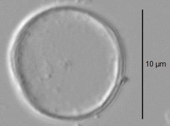 Thalassiosira minima LM6