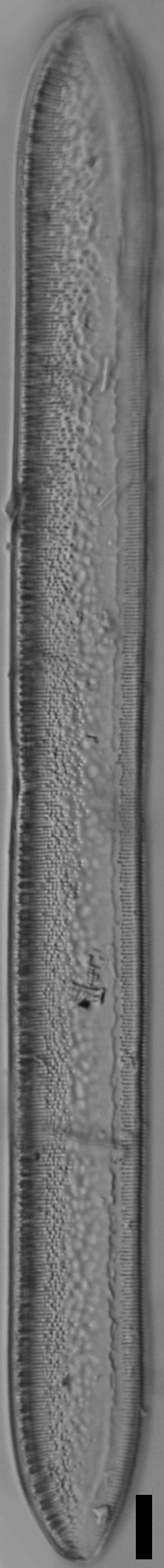 Tryblionella plana var fennica LM7