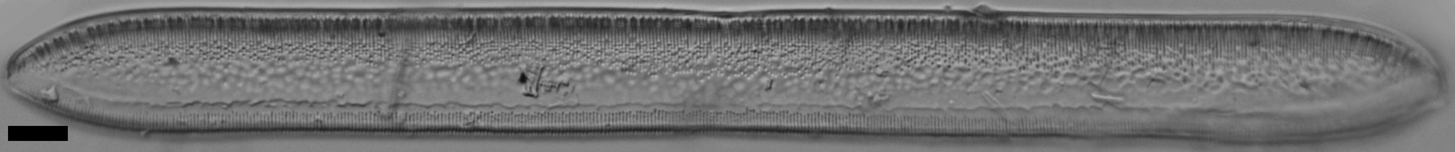 Tryblionella plana var fennica LM7