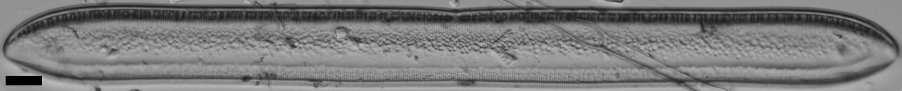 Tryblionella plana var fennica LM1