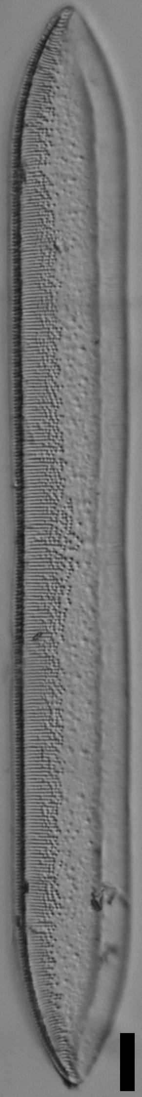 Tryblionella plana var fennica LM4