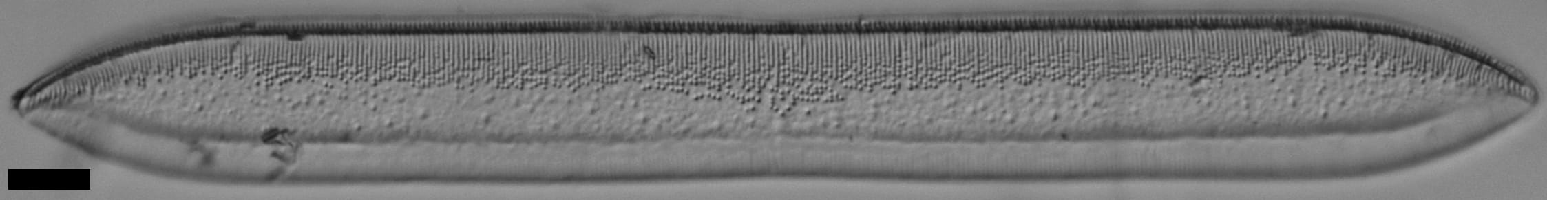 Tryblionella plana var fennica LM4