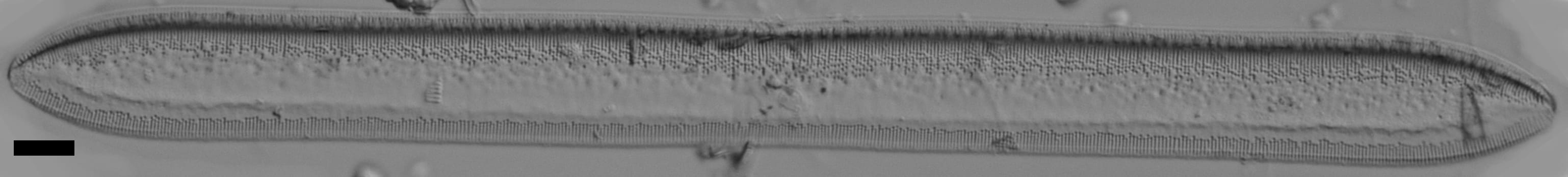 Tryblionella plana var fennica LM2