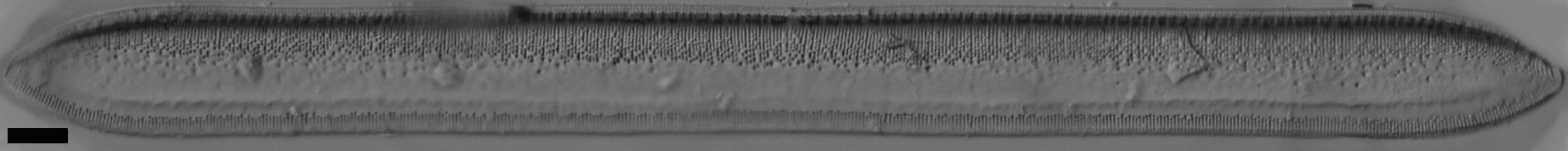 Tryblionella plana var fennica LM6