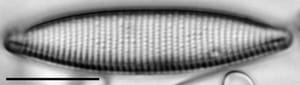 Nitzschia angustata LM2