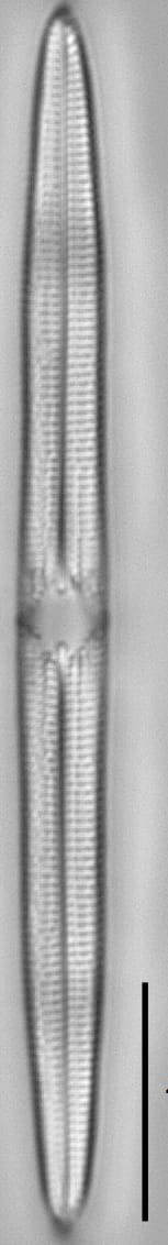 Tursiocola alata LM1