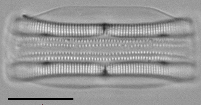 Tursiocola alata LM1