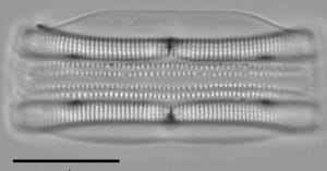 Tursiocola alata LM1