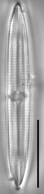 Tursiocola alata LM3