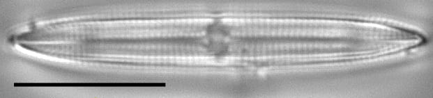 Tursiocola alata LM3