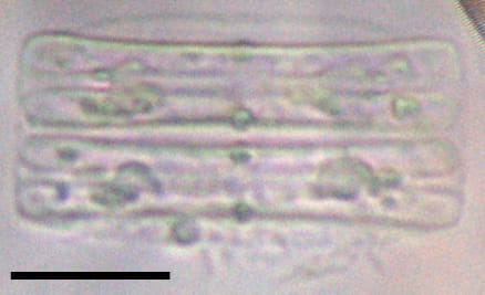 Tursiocola alata LM6