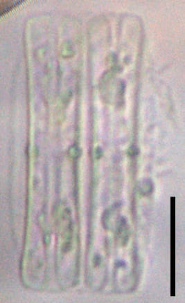 Tursiocola alata LM7