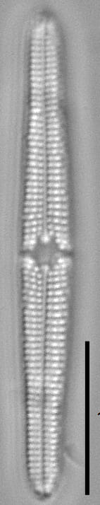 Tursiocola bondei LM1