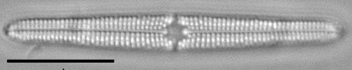 Tursiocola bondei LM1