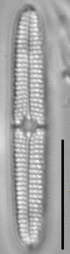 Tursiocola bondei LM2