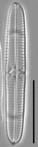 Tursiocola bondei LM3