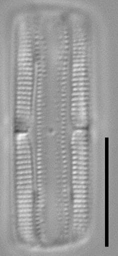 Tursiocola bondei LM4