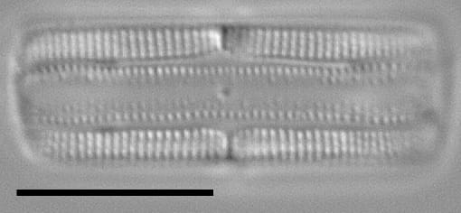 Tursiocola bondei LM4