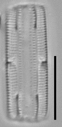 Tursiocola bondei LM5