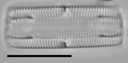 Tursiocola bondei LM5