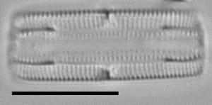 Tursiocola bondei LM5