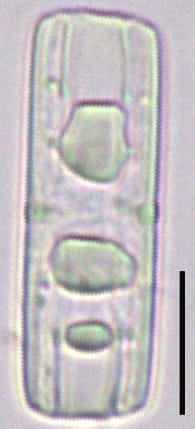 Tursiocola bondei LM6