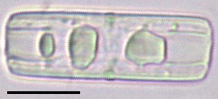 Tursiocola bondei LM6