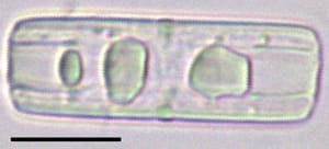 Tursiocola bondei LM6