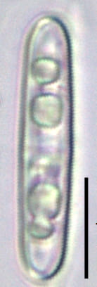 Tursiocola bondei LM7