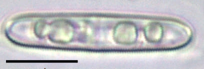 Tursiocola bondei LM7