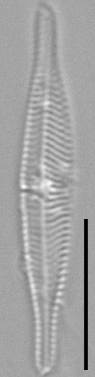 Tursiocola costata LM1 r