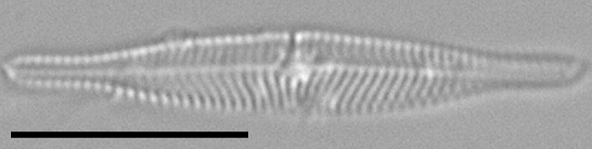 Tursiocola costata LM1 r