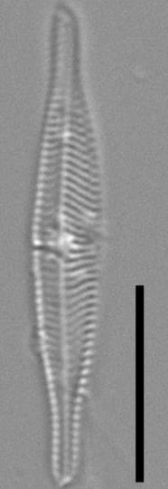 Tursiocola costata LM1