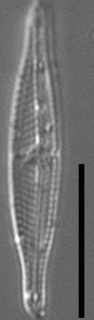 Tursiocola costata LM2